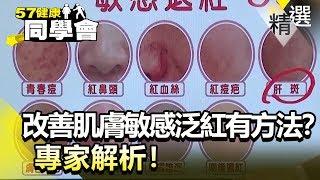 改善肌膚敏感泛紅有方法？專家解析！【健康同學會】精華篇｜隋安德 劉芯彤