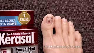 Kerasal® Fungal Nail Renewal™, Improves Appearance of Discolored or Damaged Nails