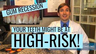 Your Teeth Might Be At HIGH Risk!