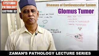 Systemic Pathology: Lecture 32 | Diseases of CVS : Day 02 - Glomus Tumor