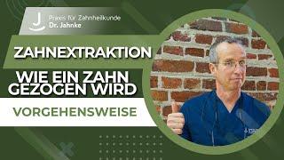 Wie wird ein Zahn gezogen? Vorgehen und Schwierigkeiten | Zahnextraktion