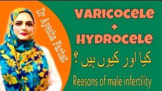 Varicocele & Hydrocele + FAQ(مردانہ بانجھ پن کی اہم وجوہات)