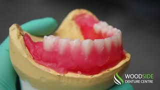 Step by Step of How Dentures Are Made