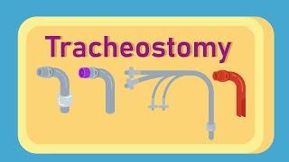 What is Tracheostomy?