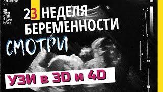 23 неделя беременности. Развитие плода. УЗИ в 3D. Что чувствует беременная. Как выглядит ребенок