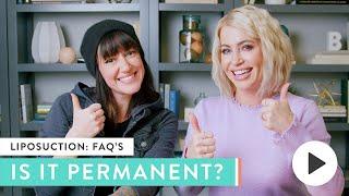 Is It True Liposuction is Permanent? | Real Answers from Real Women