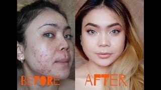 Tutupi Jerawat dengan Makeup Murah DRUGSTORE | SADDY AULIA