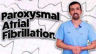What Is Paroxysmal Atrial Fibrillation? - Doctor AFib