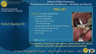 Percutaneous Endoscopic Gastrostomy, Gastrostomy with Jejunal Extension...