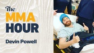 Devin Powell Tried to ‘Sleep Off’ Ruptured Testicle for Two Days