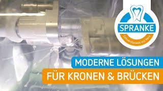 Moderne Lösungen für Kronen & Brücken  | Zahnarzt Günter Spranke