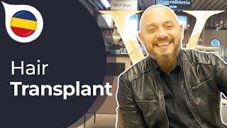 My Experience with Istanbul Vita from Romania | Hair Transplant in Istanbul / Turkey