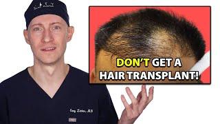 10 Reasons - Do Not Get A Hair Transplant | Hair Surgeon Reacts