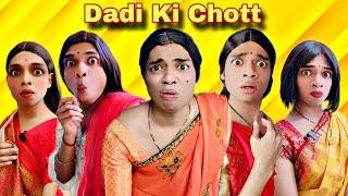 Dadi Ki Chott Ep.822 | FUNwithPRASAD | #funwithprasad