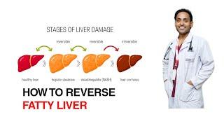 फ्याटी कलेजो( fatty liver )  कसरी निको पार्ने? | How to reverse fatty liver ?