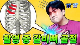 브롤 촬영하다 실제로 갈비뼈 골절됐습니다... 무려 3개나 부러졌네요...