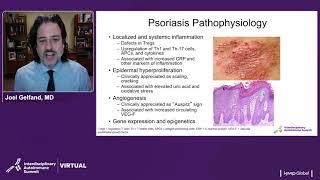 Psoriasis Treatment Update: A Focus on Targeted Therapies