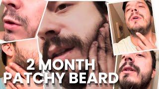 Time Lapse of my 2 Month Patchy Beard Growth