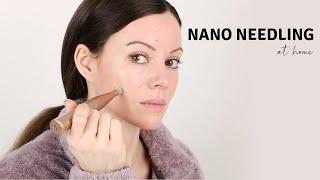 Nanoneedling At Home - How To