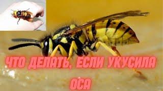 ЧТО ДЕЛАТЬ, ЕСЛИ УКУСИЛА ОСА. ПОМОЩЬ ПРИ УКУСЕ ОСЫ, ПЧЕЛЫ.