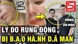 Lý do Tôn Bằng tấn công Hằng Du Mục gây rúng động