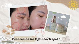 TIPS ATASI NODA HITAM DAN BEKAS JERAWAT || Review Skintific Symwhite 377 Series