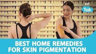 Home Remedies For Dark Spots | EP 22 | How To Treat Skin Pigmentation | Groove With Garima Bhandari