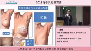 內視鏡乳房微創手術:乳房手術新紀元-2 改良式根治性全乳房切除術