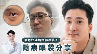 眼袋再見 自信無限  勇敢摘下厚重的眼鏡，告別疲態 ｜台南杰美學 周杰醫師