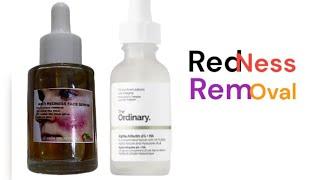 INSTANT REDNESS REMOVAL