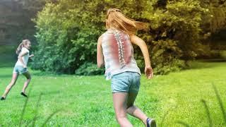 Spine Fusion Surgery Helps Correct Your Child’s Scoliosis