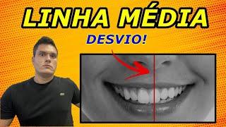 DESVIO DE LINHA MÉDIA DENTÁRIA | COMO O DENTISTA CORRIGE COM APARELHO ORTODÔNTICO?