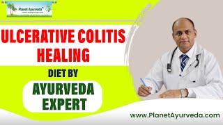 Ulcerative Colitis healing Diet by Ayurveda expert