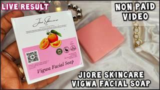 Jiore Sinche Soap Review | Jiore Sinche Facial Soap |Best skin whitening soap review | #suntan #sale