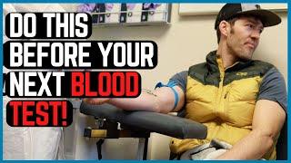 Do This Before Your Next Blood Test: 5 Tips