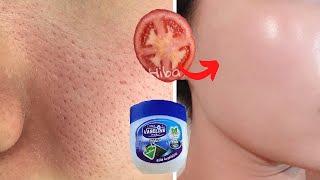 Apply tomato on your dark spots/widened pores and wrinkles and see the magic