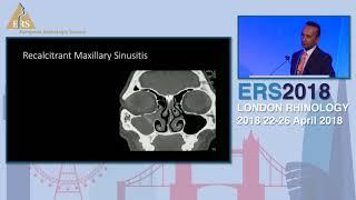 ERS London 2018, How I Do It - Approaches To The Maxillary Sinus, Salil Nair