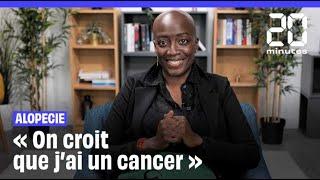 « On croit que j'ai un cancer », témoigne Reshada qui souffre d'alopécie