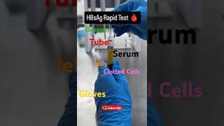 HBsAg Rapid test||HBsAg Card test #hbsag #rapid #lab #test