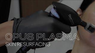 OPUS PLASMA SKIN RESURFACING