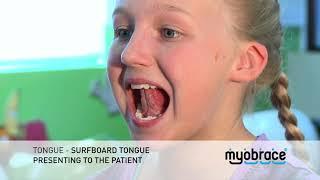 G2 Tongue   Surfboard Tongue