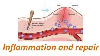 Recognition of microbes and Damaged cells | Robbin | General pathology | Chapter 3