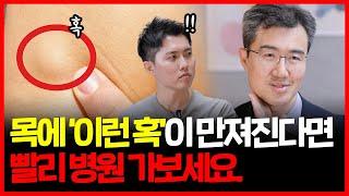 내 몸이 보내는 혈액암 신호3가지!! | 림프종