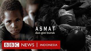 Papua: Mengapa masalah gizi buruk masih menghantui Asmat? - BBC News Indonesia