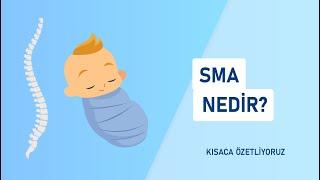 SMA nedir?