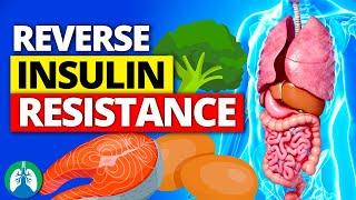 ️Top 10 Foods to REVERSE Insulin Resistance FAST