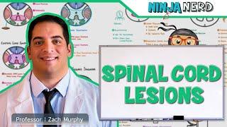 Spinal Cord Lesions: Anterior Cord, Posterior Cord, Central Cord, Brown-Sequard