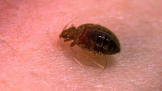 A Bedbug's Bite - Up Close! - Bang Goes the Theory - BBC