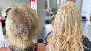 Hair topper application | extensions for fine hair and hair loss #hairextensions #hairloss