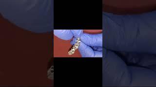 Malo’s titanium frame (cad cam milled) precision check+multiunit bioline singlepiece dental implants